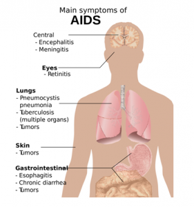 transmitted sexually diseases sexual symptoms aids stds prevention overview during signs name biology