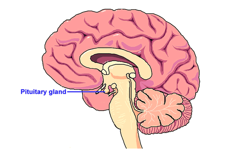 Acromegaly - Symptoms, Causes, and Treatment of Acromegaly