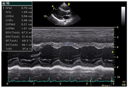 define sonogram define sonogram