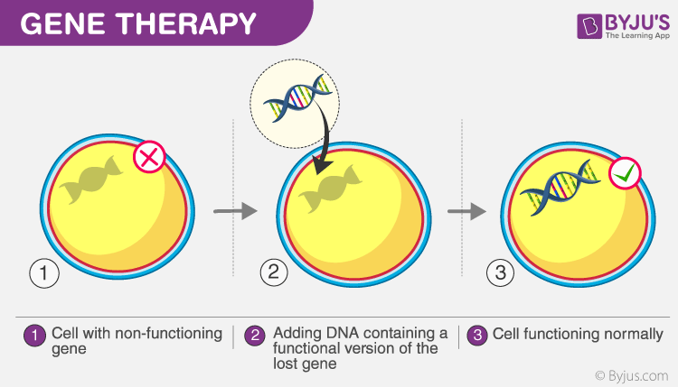 gene therapy process