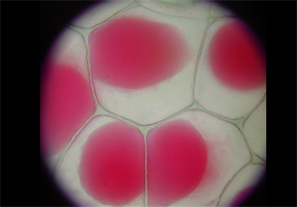 Plasmolysis