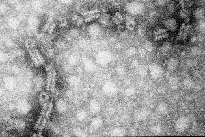 Microscopic view of Mumps virus