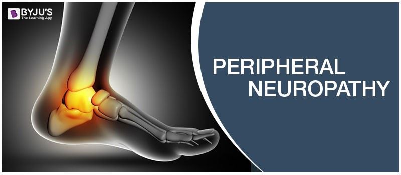 Peripheral Neuropathy