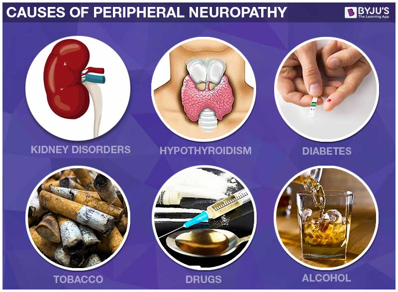 Causes of peripheral neuropathy