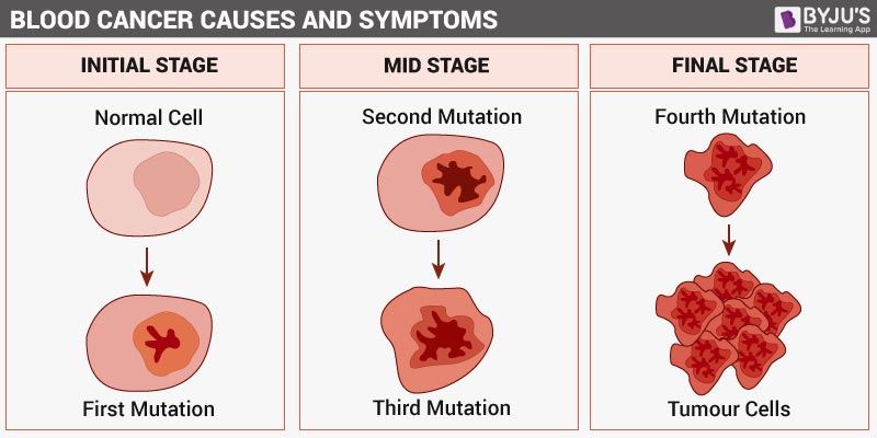 blood cancer types