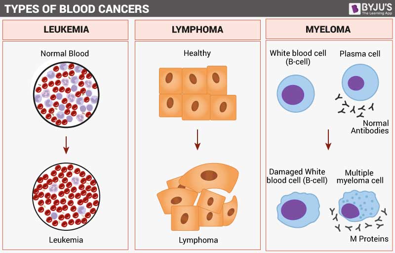 case study of blood cancer