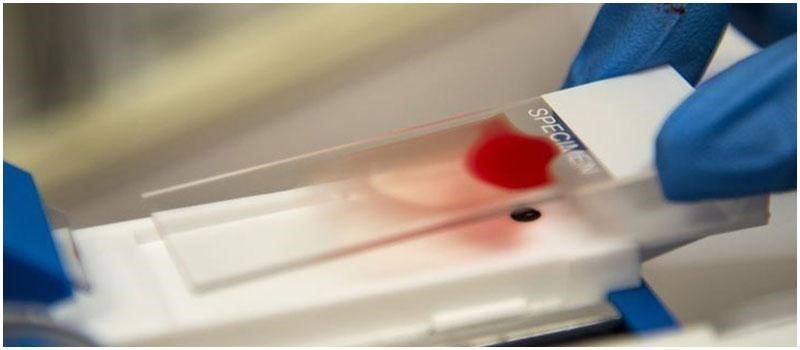 The difference between O positive and O negative blood types Stock