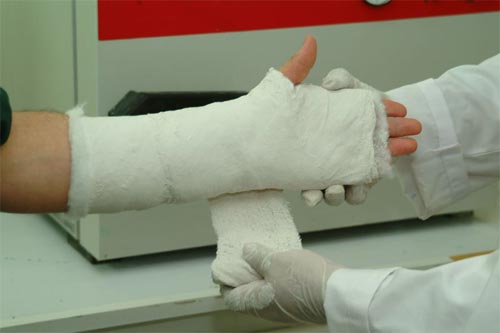 Plaster of Paris Plaster of Paris