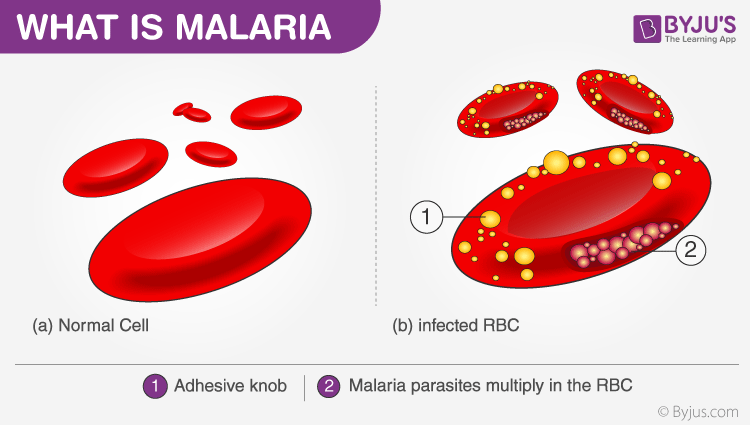 Malaria is a common disease in many countries. what is the cause of this disease?