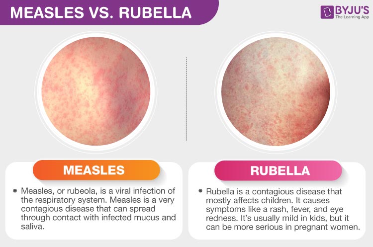 What Does Rubella Non Immune Mean In Pregnancy