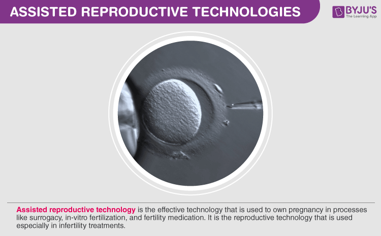 Infertility Assisted Reproductive Technologies