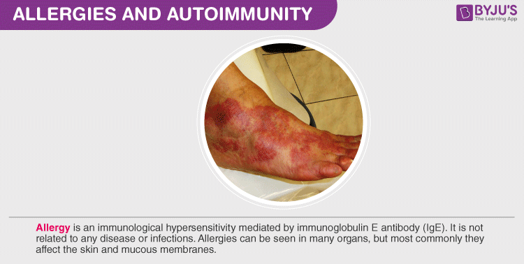 Allergies and Autoimmunity