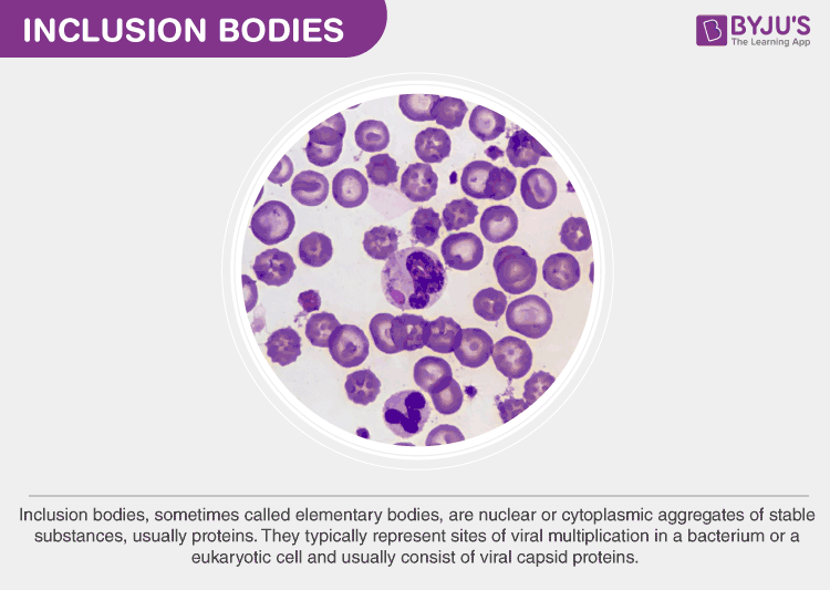 Inclusion bodies - Features & Classifications Of Inclusion Bodies