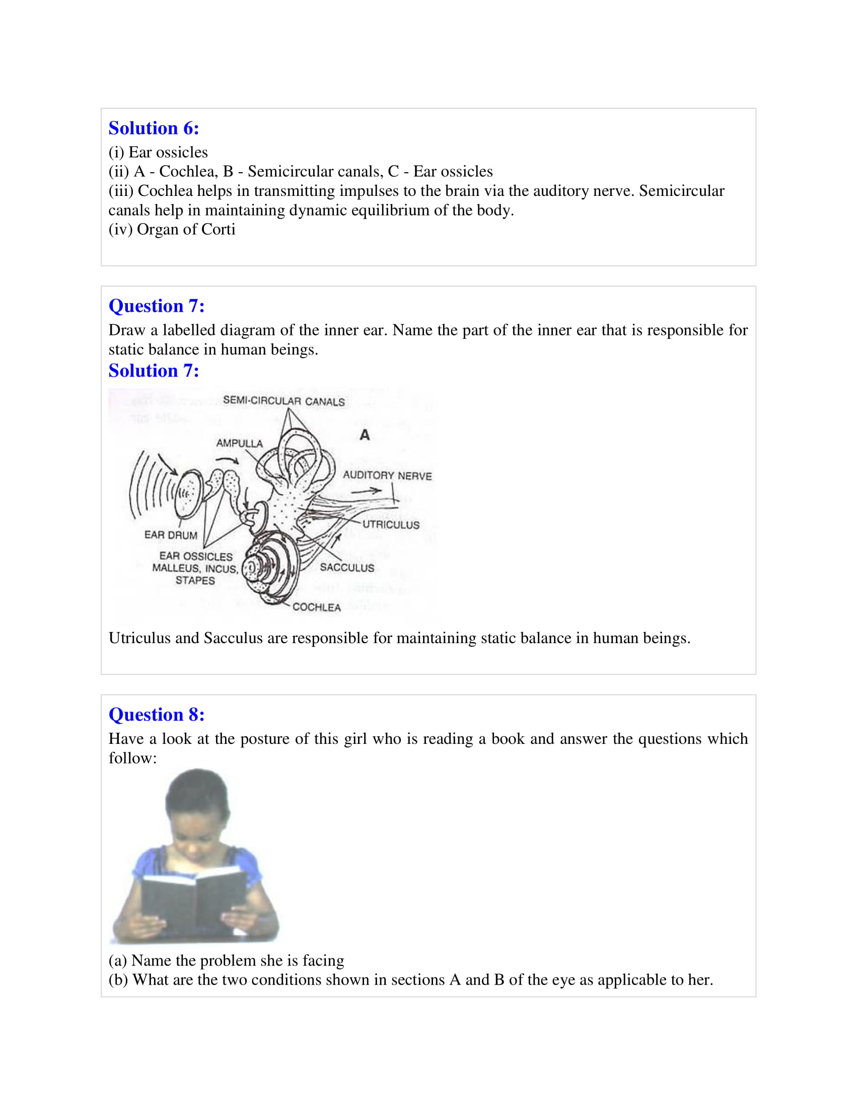 icse-selina-biology-solutions-class-10-chapter-8-the-nervous-system-24 icse-selina-biology-solutions-class-10-chapter-8-the-nervous-system-24