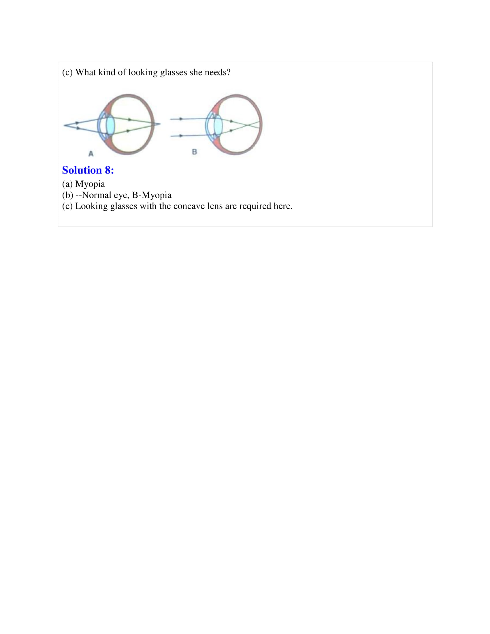 icse-selina-biology-solutions-class-10-chapter-8-the-nervous-system-25 icse-selina-biology-solutions-class-10-chapter-8-the-nervous-system-25