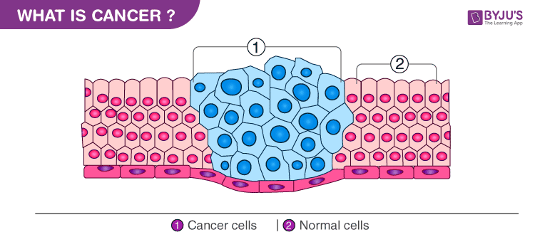 cancer development diagram