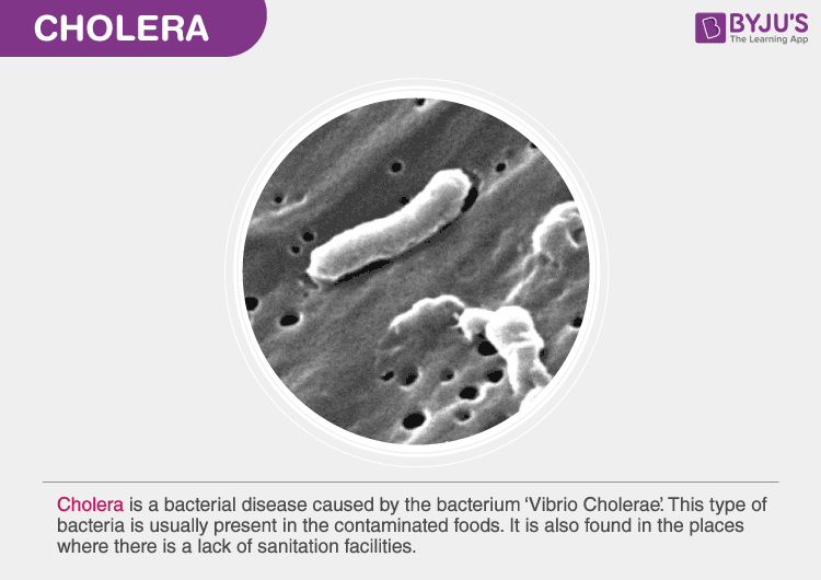 cholera bacteria diagram