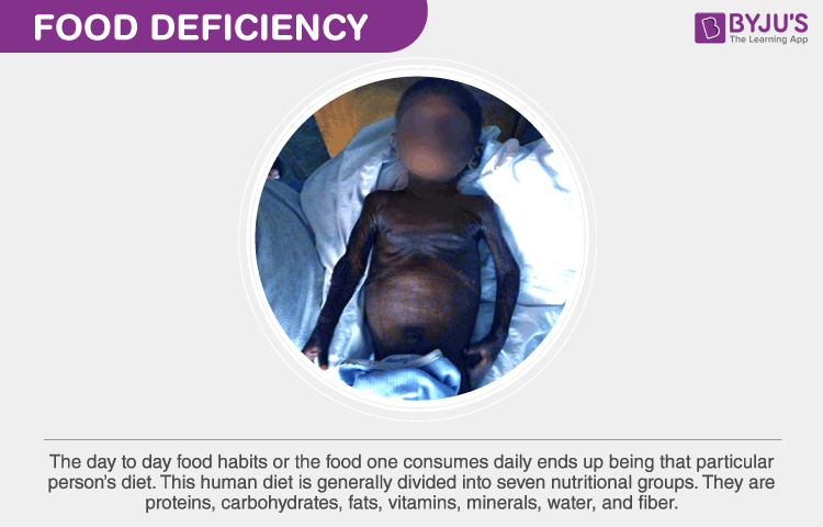 Vitamin And Mineral Deficiency Diseases Chart