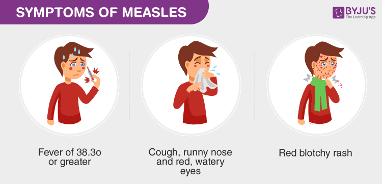 Symptoms of Measles