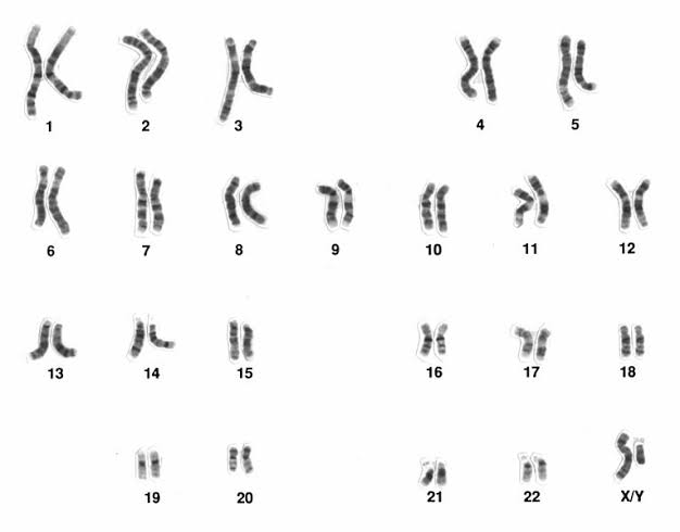 Karyotype of a human cell