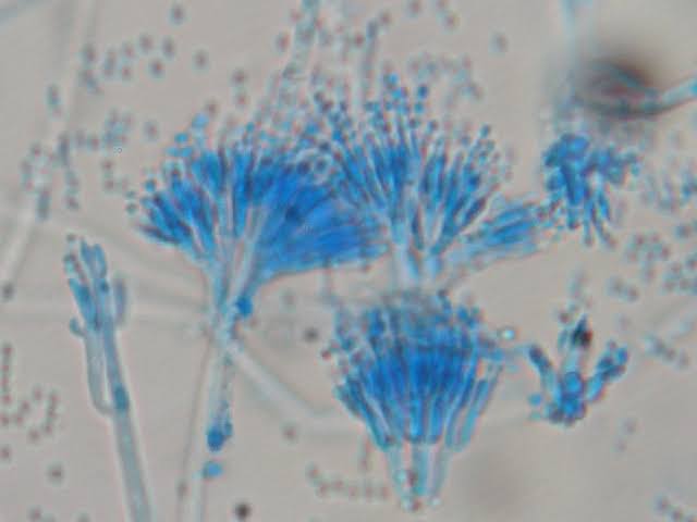 structure of penicillium mold