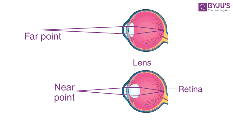 far point of eye