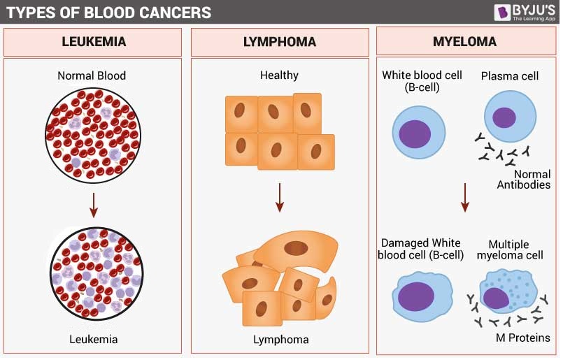 Types of Blood Cancer