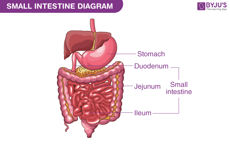 Enteritis Inflammation Of The Small Intestine 50 OFF