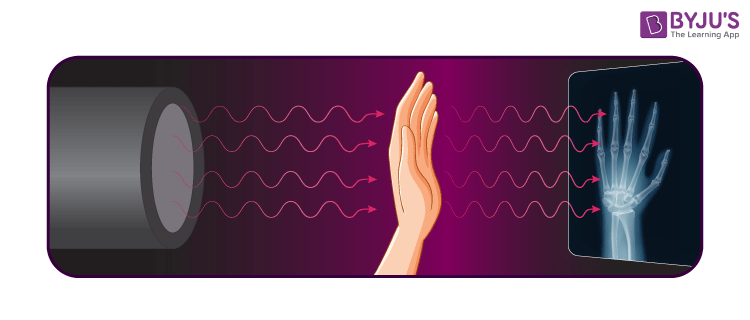 x ray waves uses