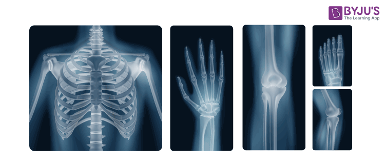 exposure to x ray