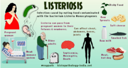 The Hidden Danger Of Listeriosis One Death Sparks Urgent Warning - rbtq8ui